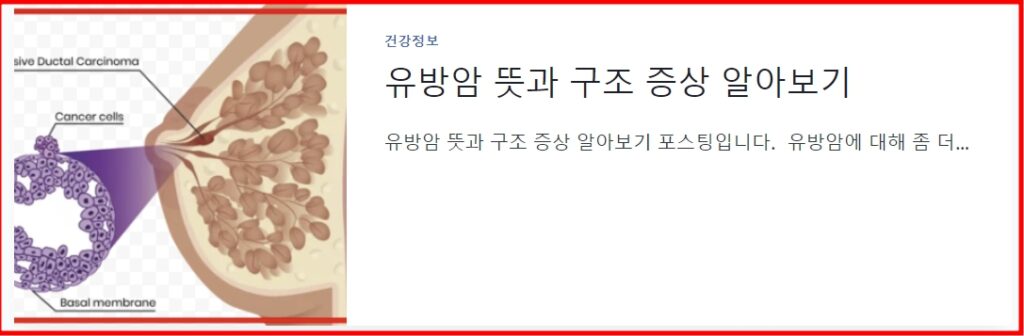 유방암 뜻과 구조 증상 알아보기 