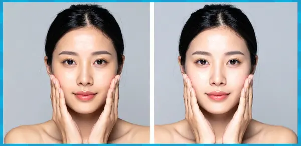 흑자 예방 점점 커지는 이유와 관리 방법 검버섯과 차이